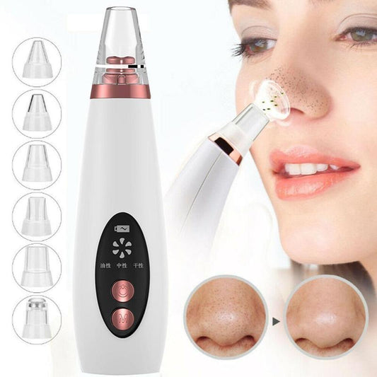 Blackhead Remover Pore Vacuum Tool